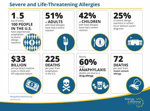 Infographic titled "Severe and Life-Threatening Allergies" with statistics on allergies, including percentages of adults and children affected, annual deaths, ER visits, and economic impact, using icons and brief text in blue and yellow.